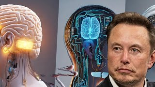 Elon Musk’s Neuralink First Human Brain Chip Implant [upl. by Applegate]