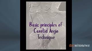 Practice Tips With Dr Lichaa The Basic Principles of Carotid Angiography Technique [upl. by Fayth274]