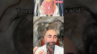 How does hyperparathyroidism affect the body Dr Babak Larian explains [upl. by Alleul]