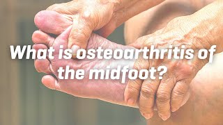 What is osteoarthritis of the midfoot [upl. by Adnwahsar167]