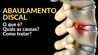 Abaulamento Discal  O que Ã© Quais os sintomas Como tratar [upl. by Matthieu]