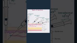 Types of injection trending medicalstudent science [upl. by Marcin]