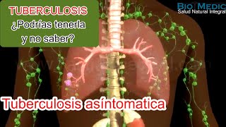 Tuberculosis ¿Podrías tenerla y no saber [upl. by Rohpotsirhc]