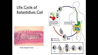 Balantidium Coli Class Ciliate Parasitology [upl. by Mercorr]