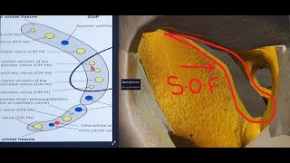 SUPERIOR ORBITAL FISSURE  3D  ANATOMY  ORBITAL APEX amp CONTENTS [upl. by Malinde650]