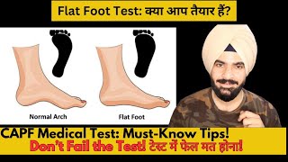 quotFlat Foot Medical Test for CAPF  Causes of Flat Foot Rejection amp How to Prevent Disqualificationquot [upl. by Euphemia847]