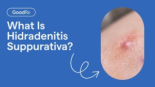 Hidradenitis Suppurativa Explained Symptoms Causes and Complications  GoodRx [upl. by Ylrebmyk896]