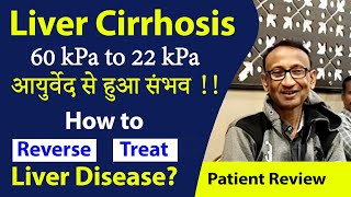 Liver Cirrhosis 60 kPa to 22 kPa आयुर्वेद से हुआ संभव  How to Reverse  Treat Liver Disease [upl. by Reginnej517]