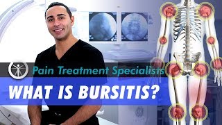 Medical Center What is Bursitis Pain Management Doctor New York 10017 [upl. by Shirlene957]