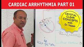 Cardiac Arrhythmia  Part 13 [upl. by Nilesoj673]