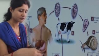 Fasciola Disease Cure Found by Divya Jyoti Singh [upl. by Uird]