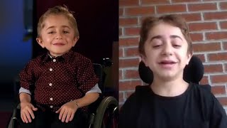 Kaleb the adorable boy from Shriners Hospital commercials is grown up and answering 7 Questions [upl. by Lanam]