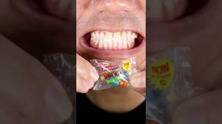 teethtapping satisfying mukbang food candy sweet dentistank tasty shortvideo memes [upl. by Bohman214]