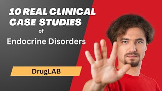 Endocrine Disorders 10 Real Clinical Case Studies  DrugLab [upl. by Millur]