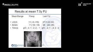 Acetabular deformity following slipped capital femoral epiphysis  Michael Millis Session 7 [upl. by Marrissa]