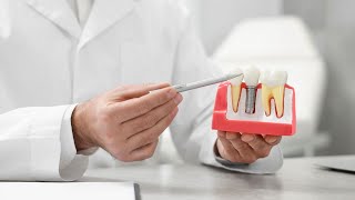 Root Canal Procedure Save Your Tooth  What Is It and When Is It Needed [upl. by Amsirac]