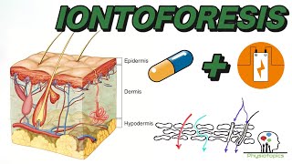 Iontoforesis explicado [upl. by Eniwtna]