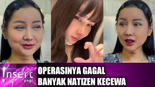 HARI INI  Wajah Hasil Oplas Tak Sesuai dengan Harapan Warganet Lucinta Luna Ngamuk [upl. by Javler]