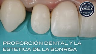 Proporción dental y la estética de la sonrisa [upl. by Ailehc]