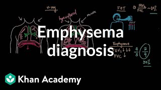 Emphysema diagnosis  Respiratory system diseases  NCLEXRN  Khan Academy [upl. by Sugar]