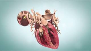 Ventricular Fibrillation VFib Terminal Cardiac Rhythm [upl. by Carberry249]