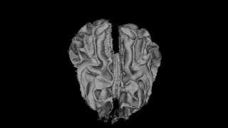 3D Reconstruction of the dog brain  White Matter and Amygdala [upl. by Ahsinuq]