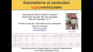 4a Les blocs supraventriculaires ECG Dr Taboulet [upl. by Yelrac]