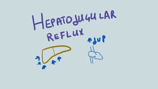 Hepatojugular Reflux Right heart failure vs CirrhosisUSMLEMRCP [upl. by Jane896]