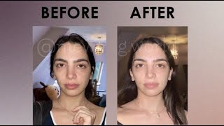 🔥 HOW TO FIX ASYMMETRICAL FACE NATURALLY 🔥🙂 [upl. by Asquith]