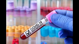 IgM and IgG antibodies represent different stages of an immune response against COVID19 [upl. by Mita]