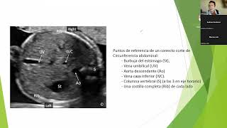 Clase 2 Ecografía Obstétrica de Segundo trimestre [upl. by Drapehs]