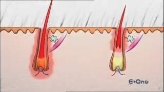 Comment ça marche Le cycle pilaire expliqué EOne by ESwin [upl. by Braeunig]