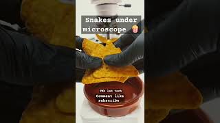 Snacks🍿 under microscope 🔬 Shocking 😳 results 💯 science lab laboratory scienceclass foryou [upl. by Ramburt876]