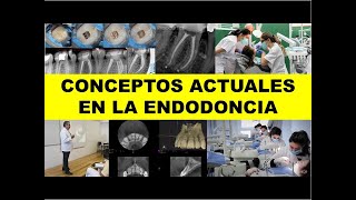 quotCONCEPTOS ACTUALES EN LA ENDODONCIAquot [upl. by Immanuel]