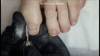 Polygel band removal after curve correction on big toe plus nail shaping and a polish application [upl. by Donell508]