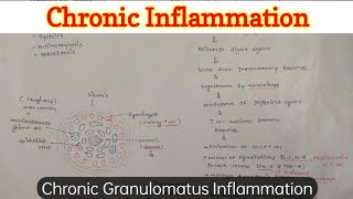 Chronic Granulomatus Inflammation [upl. by Burnley]