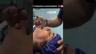 intubation orotrachealeshortsvideo youtubeshorts [upl. by Syhr]