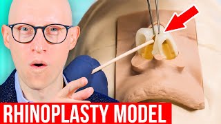 RHINOPLASTY Explained by Plastic Surgeon [upl. by Llenra]