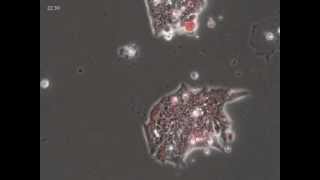 Epithelial to Mesenchymal Transition [upl. by Adnauqaj]