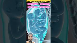 Monozygotic Twins is CalledTwins Babybaby twinmoments shortvideo [upl. by Trbor358]