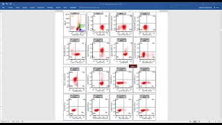 AML with NPM1 mutation [upl. by Lecram]