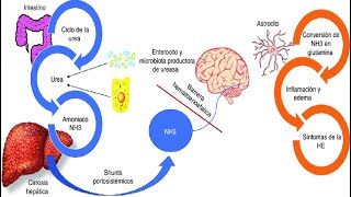 Encefalopatia hepática por cirrosis [upl. by Oirretno]