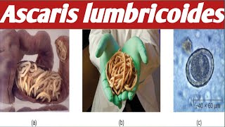 How To diagnose  Ascaris Lumbricoides [upl. by Adnarb]