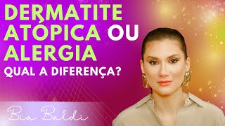 Dermatite atópica ou alergia  Dra Beatriz Franchito Baldi [upl. by Enyahs]