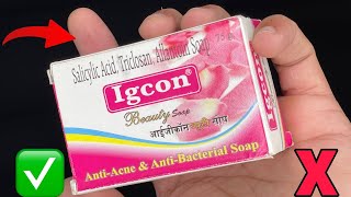 Igcon Cream Side Effects kaise thik kare  Fairness in 3 night [upl. by Nagud]