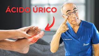 Ácido Úrico Guía Completa para evitar La Gota [upl. by Shulem690]