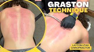 Graston Technique On Spine And Forearm  Layton Utah Chiropractor [upl. by Cosette]