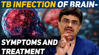 TB Infection of Brain Symptoms and Treatment DrRoopesh Kumar [upl. by Lumbard]