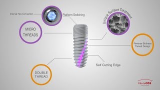 NucleOSS T6 Implant [upl. by Chaker]