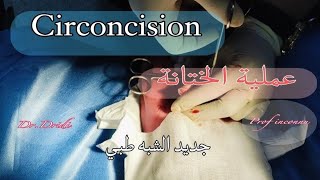 Circoncision  2025 عملية الختانة [upl. by Ashia]